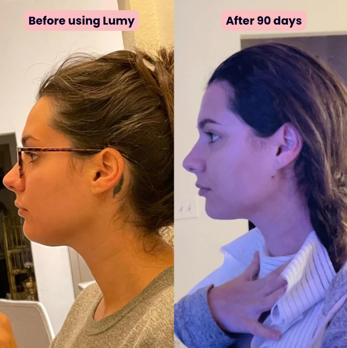 Lumy Beauty Lift Collar