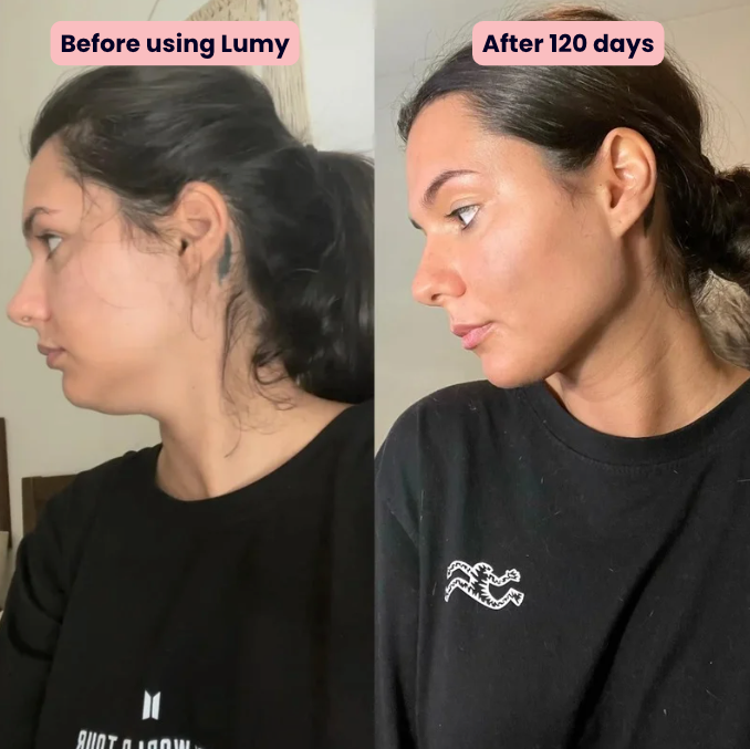 Lumy Beauty Lift Collar